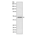 Western blot testing of human HeLa cell lysate with PDHA1 antibody. Predicted molecular weight ~43 kDa.