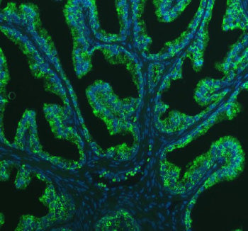 Immunofluorescent staining of BCAP29 using anti-BCAP29 antibody (green). BCAP29 was detected in an immunocytochemical section of U2OS cells. Enzyme antigen retrieval was performed using IHC enzyme antigen retrieval reagent for 15 mins. The cells were blocked with 10% goat serum. And then incubated with 5 ug/ml rabbit anti-BCAP29 antibody overnight at 4oC. DyLight 488 Conjugated Goat Anti-Rabbit IgG was used as secondary antibody at 1:500 dilution and incubated for 30 min at 37oC.