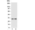 Western blot testing of SSX2 antibody and Lane 1: MCF-7; 2: HeLa cell lysate