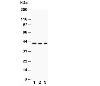 Western blot testing of GAP43 antibody and Lane 1: U87; 2: rat brain; 3: mouse brain; Predicted/observed molecular weight: ~43kDa.