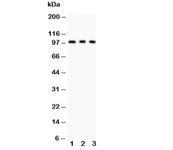 Western blot testing of CD146 antibody and Lane 1: A375; 2: HeLa; 3: HEPG2. The glycoprotein is routinely visualized between 70~120KD.