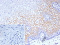IHC staining of FFPE human esophagus tissue with recombinant Desmocollin-2/3 antibody (clone DSC2/9165R). Inset: PBS used in place of primary Ab (secondary Ab negative control). HIER: boil tissue sections in pH 9 10mM Tris with 1mM EDTA for 20 min and allow to cool before testing.