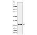 Western blot testing of human K562 cell lysate with PNMT antibody. Predicted molecular weight ~31 kDa.