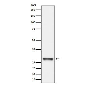 Western blot testing of human K562 cell lysate with PNMT antibody. Predicted molecular weight ~31 kDa.