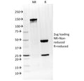 SDS-PAGE analysis of purified, BSA-free Interleukin 4 antibody (clone IL4/1597) as confirmation of integrity and purity.
