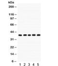Western blot testing of human 1) MCF7, 2) HeLa, 3) A549, 4) HepG2 and 293 cell lysate with Cdk7 antibody. Predicted/observed molecular weight ~37 kDa.
