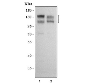 Western blot testing of human 1) 293T and 2) HeLa cell lysate with Nicastrin antibody. Predicted molecular weight ~78 kDa, but can be observed at up to ~160 kDa due to glycosylation.