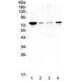 Western blot testing of human 1) HeLa, 2) placenta, 3) MCF7 and 4) SK-OV-3 lysate with RANK antibody at 0.5ug/ml. Predicted molecular weight ~66 kDa, routinely observed at 80~100 kDa.