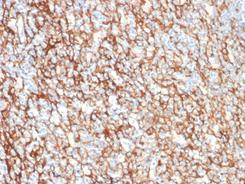 IHC staining of FFPE human tonsil tissue with CD73 antibody (clone NT5E/2505). HIER: boil tissue sections in pH9 10mM Tris with 1mM EDTA for 10-20 min and allow to cool before testing.