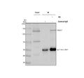 Immunoprecipitating TAOK1 in Hela whole cell lysate. Western blot analysis of TAOK1 using anti-TAOK1 antibody. Lane 1: Hela whole cell lysates (30ug), Lane 2: Rabbit control IgG instead of anti-TAOK1 antibody in Hela whole cell lysate, Lane 3: anti-TAOK1 antibody (2ug) + Hela whole cell lysate (500ug). After electrophoresis, proteins were transferred to a membrane.