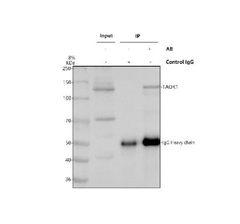 Immunoprecipitating TAOK1 in Hela whole cell lysate. Western blot analysis of TAOK1 using anti-TAOK1 antibody. Lane 1: Hela whole cell lysates (30ug), Lane 2: Rabbit control IgG instead of anti-TAOK1 antibody in Hela whole cell lysate, Lane 3: anti-TAOK1 antibody (2ug) + Hela whole cell lysate (500ug). After electrophoresis, proteins were transferred to a membrane.