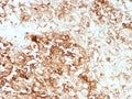 IHC staining of FFPE human adrenal gland tissue with recombinant CLU antibody (clone rCLU/9149). HIER: boil tissue sections in pH 9 10mM Tris with 1mM EDTA for 20 min and allow to cool before testing.