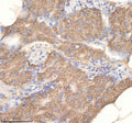 IHC staining of zebrafish Pdcd10a/b protein using Zebrafish Pdcd10 antibody, HRP-labeled secondary and DAB substrate. Pdcd10 was detected in a paraffin-embedded section of zebrafish pancreas tissue. HIER: boil tissue sections in pH8 EDTA for 20 min and allow to cool before testing.