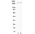 Western blot testing of human 1) HeLa and 2) HepG2 cell lysate with Nestin antibody. Predicted molecular weight ~177 kDa but can be observed at up to 240 kDa.