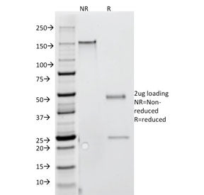 SDS-PAGE analysis of purified, BSA-free Interferon gamma antibody (clone G-23) as confirmation of integrity and purity.