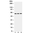 Western blot testing of 1) rat lung, 2) mouse lung and 3) HepG2 lysate with EPHX2 antibody at 0.5ug/ml. Predicted molecular weight: ~63/57 kDa (isoforms 1/2).