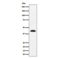 Western blot testing of human 293T cell lysate with NUDT19 antibody. Predicted molecular weight ~42 kDa.