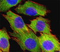 Fluorescent confocal image of C2C12 cell stained with AKT2 antibody at 1:25. Immunoreactivity is localized to the cytoplasm.