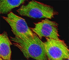 Fluorescent confocal image of C2C12 cell stained with AKT2 antibody at 1:25. Immunoreactivity is localized to the cytoplasm.