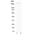 Western blot testing of human 1) HeLa and 2) A549 cell lysate with ABCC1 antibody at 0.5ug/ml. Predicted molecular weight: 152-172 kDa (multiple isoforms), can be observed at ~190 kDa, observed here at ~220 kDa.