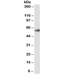 Western blot testing of rat lung lysate with biotinylated FOXA2 antibody at 1.5ug/ml. An NAP blocker was used in place of non-fat milk as blocking solution and diluent. (1)