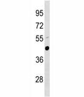 Urokinase antibody western blot analysis in mouse lung tissue lysate.