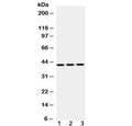 Western blot testing of 1) rat liver, 2) mouse NIH3T3 and 3) human HepG2 lysate with EBP1 antibody at 0.5ug/ml. Observed molecular weight 42 kDa (p42 isoform) and 48 kDa (p48 isoform).