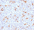 IHC testing of FFPE human pancreas with CFTR antibody (clone CFTR1-1). Staining of FFPE tissue is enhanced by boiling tissue sections in 10mM Tris with 1mM EDTA, pH9 for 10-20 min followed by cooling at RT for 20 min.