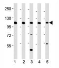Western blot testing of Mertk antibody at 1:2000 dilution. Lane 1: mouse kidney lysate; 2: mouse liver lysate; 3: NIH3T3 lysate; 4: rat kidney lysate; 5: rat liver lysate; Predicted molecular weight: 110~205 kDa depending on glycosylation level