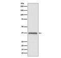 Western blot testing of human HeLa cell lysate with ERCC1 antibody. Predicted molecular weight ~36 kDa.