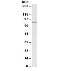 Western blot testing of A431 lysate with ABCB5 antibody at 0.3ug/ml. Predicted molecular weight ~90kDa, observed here at ~80kDa.