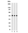 Western blot of 1) K562, 2) 293 and 3) A549 cell lysates using Napsin A antibody (clone NPSNA-1). Expected molecular weight: 38-45 kDa depending on glycosylation level.