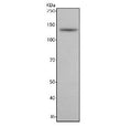 Western blot testing of rat brain tissue lysate with NRCAM antibody. Predicted molecular weight ~144 kDa.