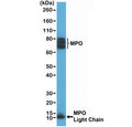 Western blot testing of human HL60 cell lysate with recombinant Myeloperoxidase antibody at 1:200 dilution. Expected molecular weight: ~13 kDa (light/beta chain), ~73 kDa (heavy/alpha chain + light/beta chain), ~150 kDa (mature form). The protein may be observed at higher molecular weights due to glycosylation.