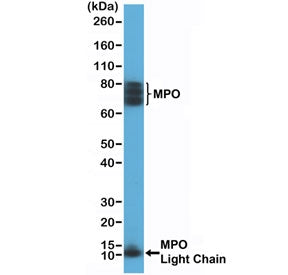Western blot testing of human HL60 cell lysate with recombinant Myeloperoxidase antibody at 1:200 dilution. Expected molecular weight: ~13 kDa (light/beta chain), ~73 kDa (heavy/alpha chain + light/beta chain), ~150 kDa (mature form). The protein may be observed at higher molecular weights due to glycosylation.