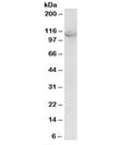 Western blot testing of A431 lysate with OAS3 antibody at 2ug/ml. Predicted molecular weight: ~121kDa, observed here at ~110kDa.