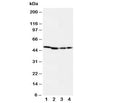 Western blot testing of MEK1 antibody and Lane 1: rat skeletal muscle; 2: rat kidney; 3: (h) CEM; 4: (h) COLO20 cell lysate. Predicted molecular weight: 43 kDa.