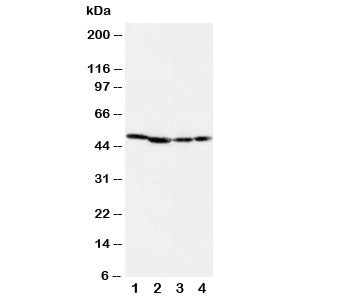 Western blot testing of MEK1 antibody and Lane 1: rat skeletal muscle; 2: rat kidney; 3: (h) CEM; 4: (h) COLO20 cell lysate. Predicted molecular weight: 43 kDa.