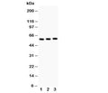 Western blot testing of CYP11A1 antibody and Lane 1: rat testis; 2: mouse testis; 3: mouse brain; Expected molecular weight: 50-60 kDa.
