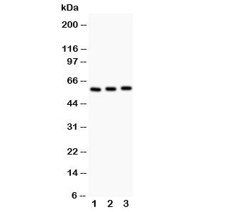 Western blot testing of CYP11A1 antibody and Lane 1: rat testis; 2: mouse testis; 3: mouse brain; Expected molecular weight: 50-60 kDa.
