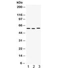 Western blot testing of 1) rat thymus, 2) rat spleen, and 3) human SMMC-7721 lysate with CAP1 antibody. Predicted molecular weight ~52 kDa, but routinely observed at 55-60 kDa.