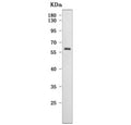 Western blot testing of human HeLa cell lysate with CYP27B1 antibody. Predicted molecular weight ~57 kDa.