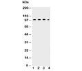 Western blot testing of ICAM-1 antibody and Lane 1: HEPG2; 2: K562; 3: A549; 4: HT1080 lysate. Predicted molecular weight: ~58/75-115 kDa (unmodified/glycosylated).