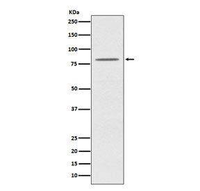 Western blot testing of human HeLa cell lysate with OPA1 antibody. Predicted molecular weight: 111-120 kDa with multiple smaller isoforms from 81-95 kDa.