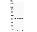 Western blot testing of Caspase-3 antibody (0.5ug/ml) and Lane 1: rat liver; 2: MCF-7; 3: SMMC-7721; 4: HT1080 lysate. Predicted molecular weight ~31 kDa.
