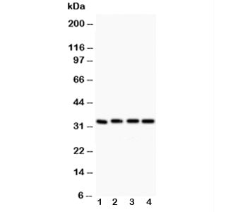 Western blot testing of Caspase-3 antibody (0.5ug/ml) and Lane 1: rat liver; 2: MCF-7; 3: SMMC-7721; 4: HT1080 lysate. Predicted molecular weight ~31 kDa.