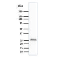 Western blot testing of human brain lysate with UchL1 antibody (clone UCHL1/841). Predicted molecular weight ~25 kDa.