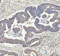 Immunohistochemical staining of ARHGEF12L using anti-ARHGEF12L antibody. ARHGEF12L was detected in a paraffin-embedded section of rat brain tissue. Heat mediated antigen retrieval was performed in EDTA buffer (pH 8.0, epitope retrieval solution). The tissue section was blocked with 10% goat serum. The tissue section was then incubated with 2 ug/ml rabbit anti-ARHGEF12L antibody overnight at 4oC. Peroxidase Conjugated Goat Anti-rabbit IgG was used as secondary antibody and incubated for 30 min at 37oC.