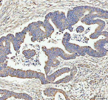 Immunohistochemical staining of ARHGEF12L using anti-ARHGEF12L antibody. ARHGEF12L was detected in a paraffin-embedded section of rat brain tissue. Heat mediated antigen retrieval was performed in EDTA buffer (pH 8.0, epitope retrieval solution). The tissue section was blocked with 10% goat serum. The tissue section was then incubated with 2 ug/ml rabbit anti-ARHGEF12L antibody overnight at 4oC. Peroxidase Conjugated Goat Anti-rabbit IgG was used as secondary antibody and incubated for 30 min at 37oC.