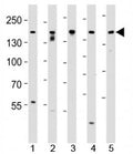 Western blot analysis of lysate from SH-SY5Y, MCF-7, PC3, LNCaP, HeLa, cell line (left to right) using Tuberin antibody at 1:1000 for each lane.